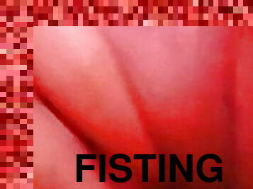 fisting