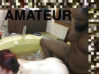 Anal Tub