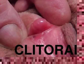 CLITORAL STIMULATION WITH A PULSE VACUUM TUBE